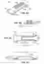 Fig. 08 - Scleral prosthesis for treating presbyopia and other eye disorders and related devices and methods