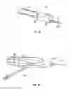 Fig. 16 - Method of securing a leaflet anchor to a mitral valve leaflet