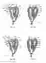 Fig. 09 - Device for the deployment of a system of guide wires within a cardiac chamber for implanting a prosthetic heart valve