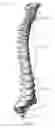 Fig. 02 - Expandable interbody spinal fusion device capable of being deployed endoscopically
