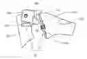 Fig. 01 - Method for surgical application of a glenoid prosthesis component of a shoulder joint prosthesis and relating surgical instruments