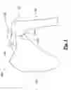 Fig. 02 - Method for surgical application of a glenoid prosthesis component of a shoulder joint prosthesis and relating surgical instruments