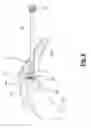 Fig. 07 - Method for surgical application of a glenoid prosthesis component of a shoulder joint prosthesis and relating surgical instruments