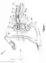 Fig. 02 - Bidirectional biomechanical prosthetic full finger configured for abduction and adduction with MCP pivot and multiple-finger ring