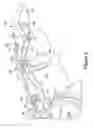 Fig. 04 - Bidirectional biomechanical prosthetic full finger configured for abduction and adduction with MCP pivot and multiple-finger ring