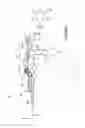 Fig. 07 - Bidirectional biomechanical prosthetic full finger configured for abduction and adduction with MCP pivot and multiple-finger ring