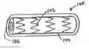 Fig. 01 - Expandable endograft devices, systems, and methods of using the same to partially or fully occlude a luminal organ