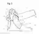 Fig. 04 - Ankle Support