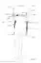 Fig. 22 - Trunk supporting exoskeleton and method of use