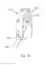 Fig. 40 - Trunk supporting exoskeleton and method of use