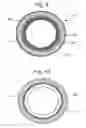 Fig. 06 - Implant containing rods