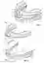 Fig. 02 - Full movement jaw advancement oral appliance to reduce the effects of snoring and/or sleep apnea