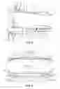 Fig. 03 - Full movement jaw advancement oral appliance to reduce the effects of snoring and/or sleep apnea