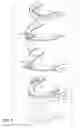 Fig. 05 - Full movement jaw advancement oral appliance to reduce the effects of snoring and/or sleep apnea