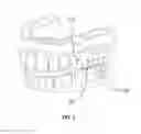 Fig. 03 - Method for vacuum-forming dental appliance