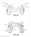 Fig. 05 - Oral appliance device