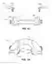 Fig. 06 - Oral appliance device