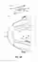 Fig. 07 - Oral appliance device