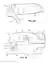 Fig. 09 - Oral appliance device