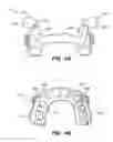 Fig. 05 - Oral appliance device