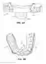 Fig. 08 - Oral appliance device