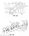 Fig. 04 - ORAL APPLIANCE DEVICE