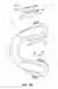 Fig. 07 - ORAL APPLIANCE DEVICE