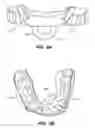 Fig. 08 - ORAL APPLIANCE DEVICE