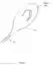 Fig. 05 - OPHTHALMIC SURGICAL DEVICE WITH ADJUSTABLE FILAMENT AND METHOD OF USE