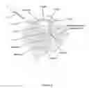 Fig. 06 - OPHTHALMIC SURGICAL DEVICE WITH ADJUSTABLE FILAMENT AND METHOD OF USE