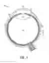 Fig. 02 - Lacrimal implants and related methods