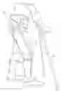 Fig. 01 - Wearable robotic device