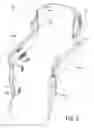 Fig. 04 - Wearable robotic device