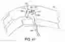 Fig. 32 - Wearable robotic device