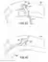 Fig. 33 - Wearable robotic device