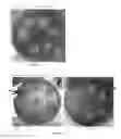 Fig. 02 - Probiotic bacterial strains and symbiotic composition containing the same intended for infant food