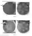 Fig. 04 - Probiotic bacterial strains and symbiotic composition containing the same intended for infant food