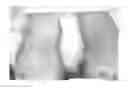 Fig. 01 - DIABETIC FOOT CREAM