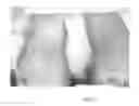 Fig. 02 - DIABETIC FOOT CREAM