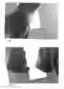 Fig. 03 - DIABETIC FOOT CREAM