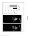 Fig. 06 - Compositions, methods and uses comprising teneurin C-terminal associated peptide -1 (TCAP-1) for enhancing muscle performance