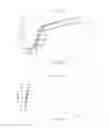 Fig. 06 - THREADS OF CROSS-LINKED HYALURONIC ACID AND HYDROXYAPATITE