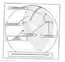 Fig. 01 - Pericardial Space Imaging for Cardiac Support Device Implantation