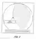 Fig. 03 - Pericardial Space Imaging for Cardiac Support Device Implantation