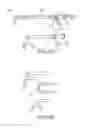 Fig. 06 - CONTINUOUS ANESTHESIA NERVE CONDUCTION APPARATUS, SYSTEM AND METHOD THEREOF