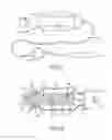 Fig. 07 - CONTINUOUS ANESTHESIA NERVE CONDUCTION APPARATUS, SYSTEM AND METHOD THEREOF