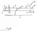 Fig. 02 - Bypass catheter