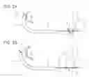 Fig. 03 - Medical apparatus comprising a bendably deformable portion