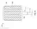 Fig. 07 - Pouch forming catheter