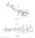 Fig. 02 - Balloon catheter inflation apparatus and methods